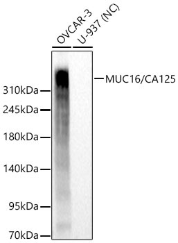MUC16/CA125 Rabbit Monoclonal Antibody