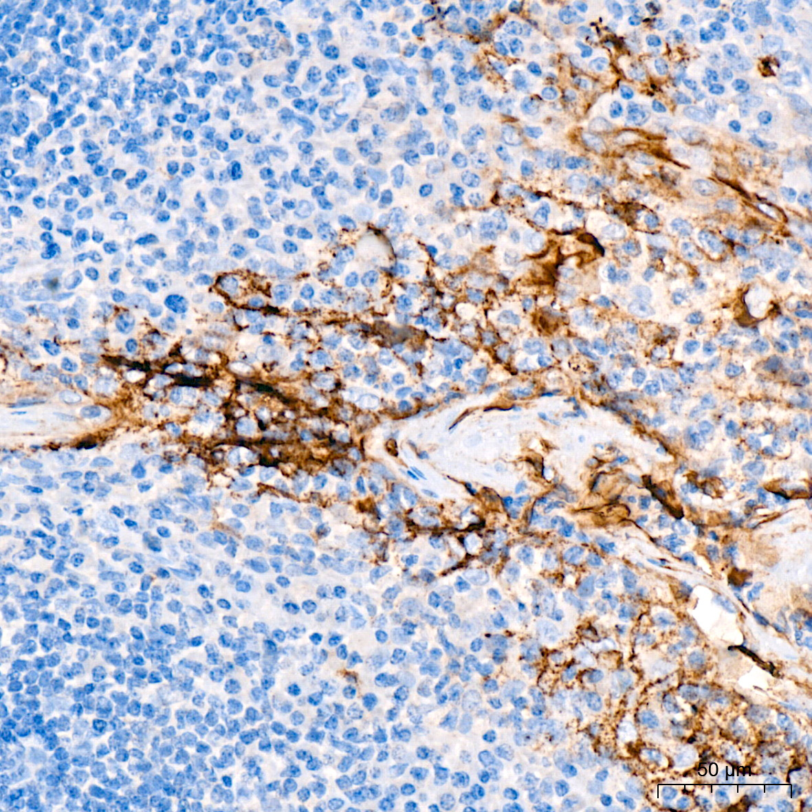 MUC16/CA125 Rabbit Monoclonal Antibody - Image 2