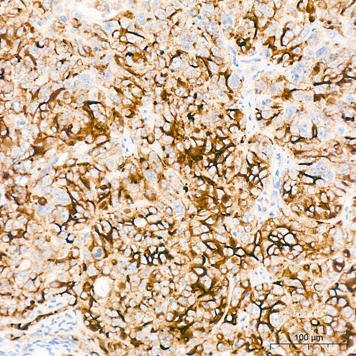 MUC16/CA125 Rabbit Monoclonal Antibody - Image 3