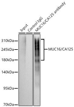 MUC16/CA125 Rabbit Monoclonal Antibody - Image 4