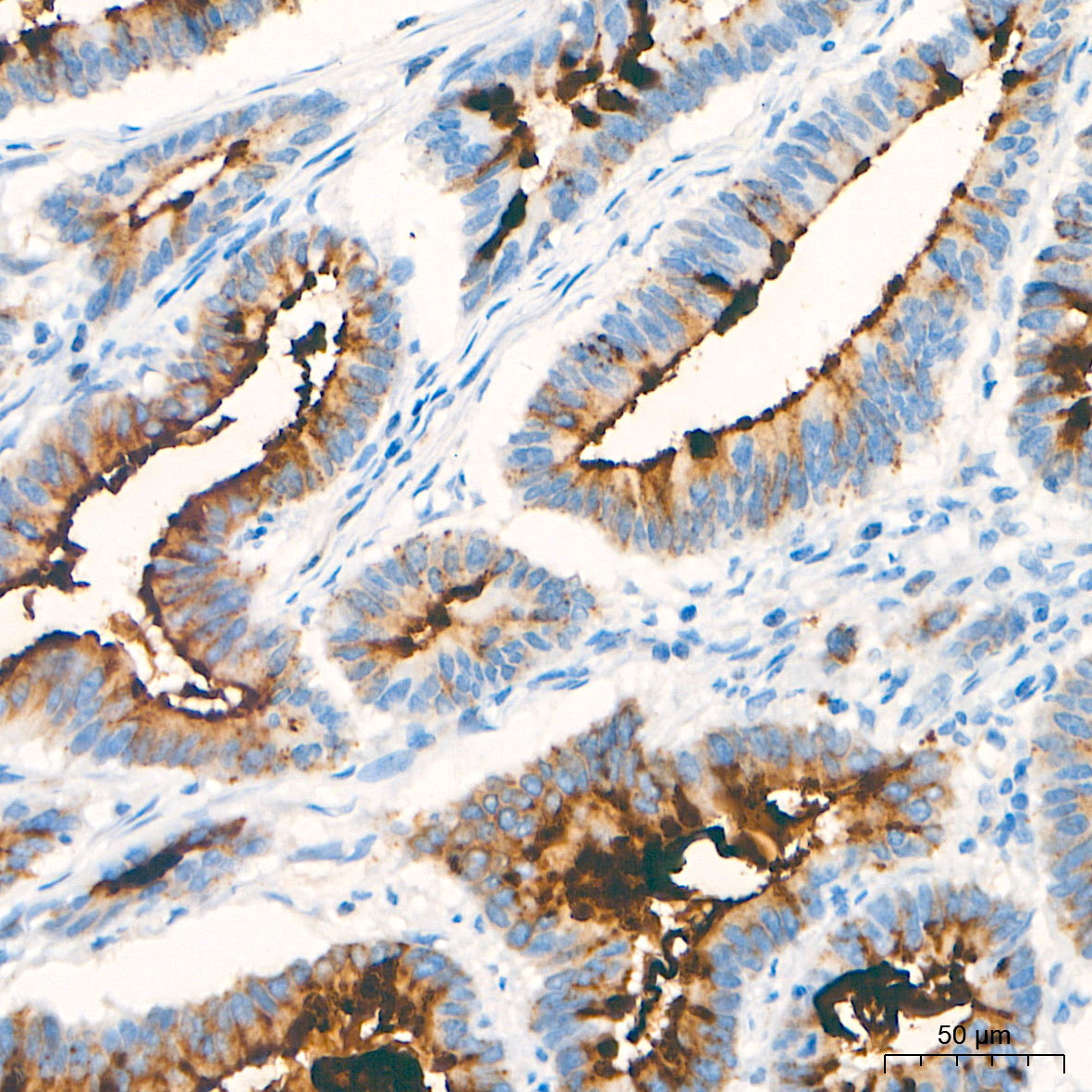 MUC2 Rabbit Monoclonal Antibody