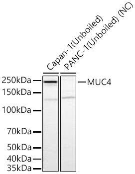 MUC4 Rabbit Monoclonal Antibody
