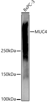 MUC4 Rabbit Polyclonal Antibody