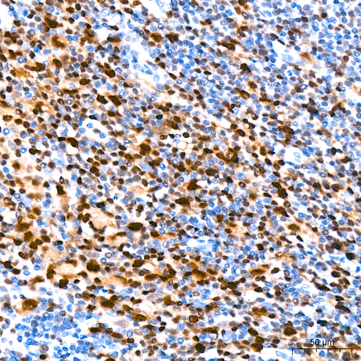 MUM1 Rabbit Monoclonal Antibody