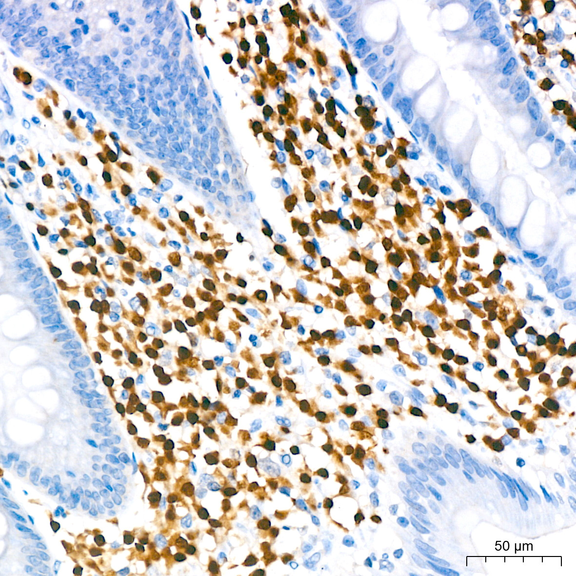 MUM1 Rabbit Monoclonal Antibody - Image 2