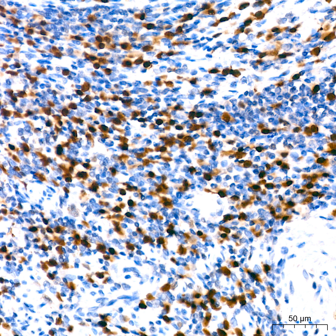 MUM1 Rabbit Monoclonal Antibody - Image 3