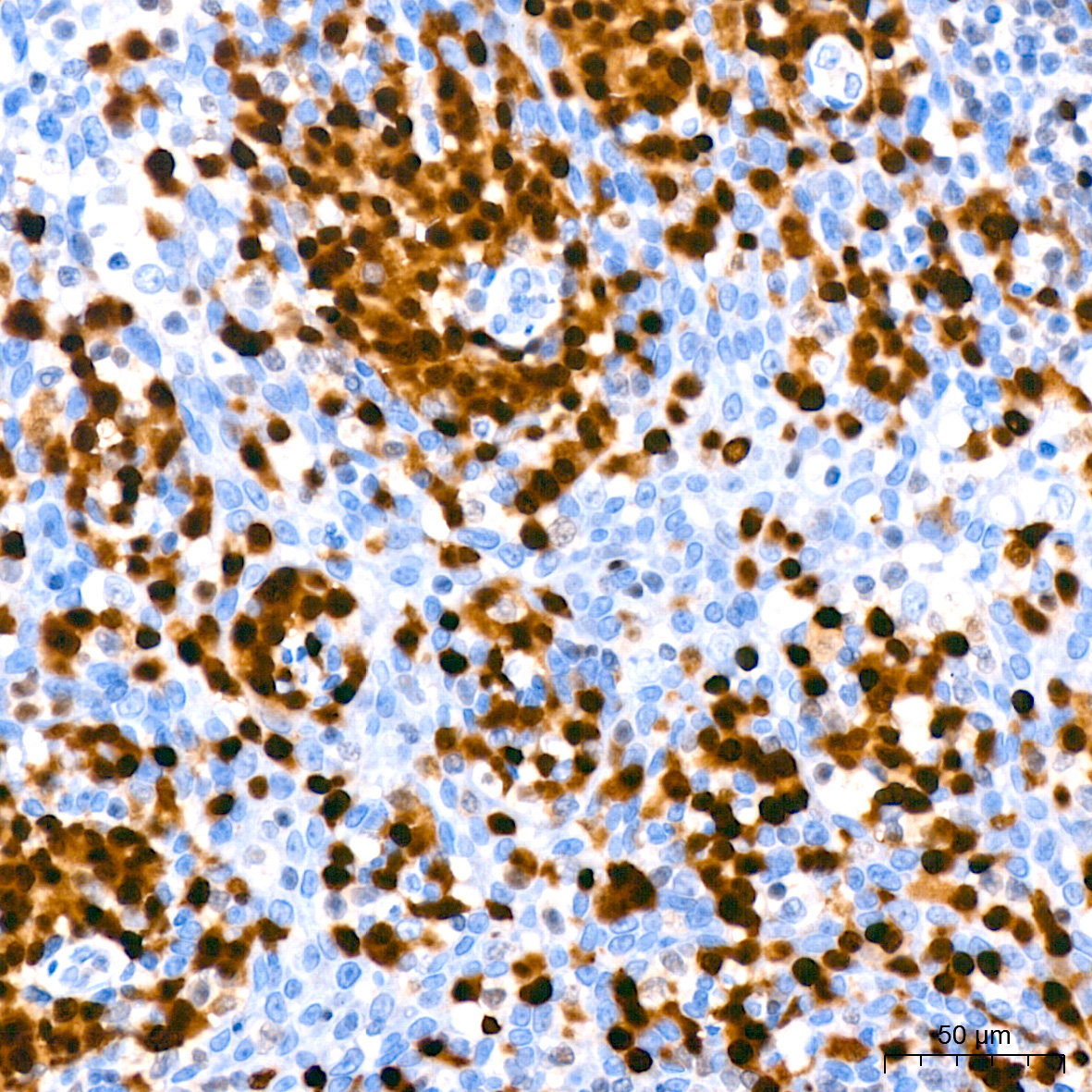 MUM1 Rabbit Monoclonal Antibody - Image 4