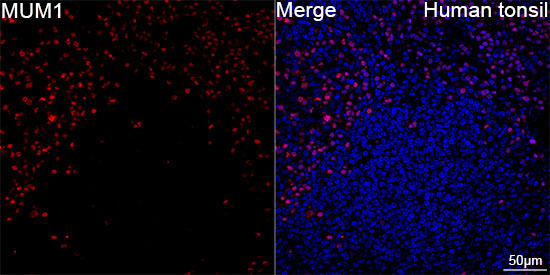 MUM1 Rabbit Monoclonal Antibody - Image 5