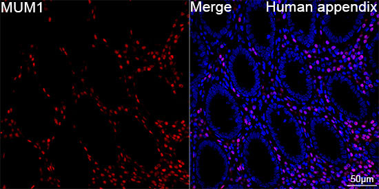 MUM1 Rabbit Monoclonal Antibody - Image 6
