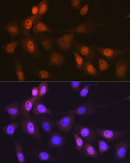 Musashi-1 (MSI1) Rabbit Monoclonal Antibody - Image 2
