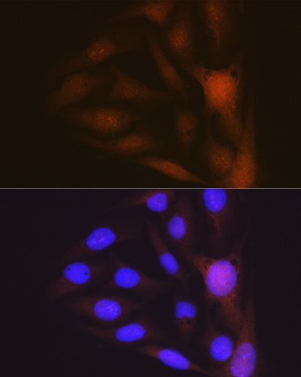Musashi-1 (MSI1) Rabbit Monoclonal Antibody - Image 3