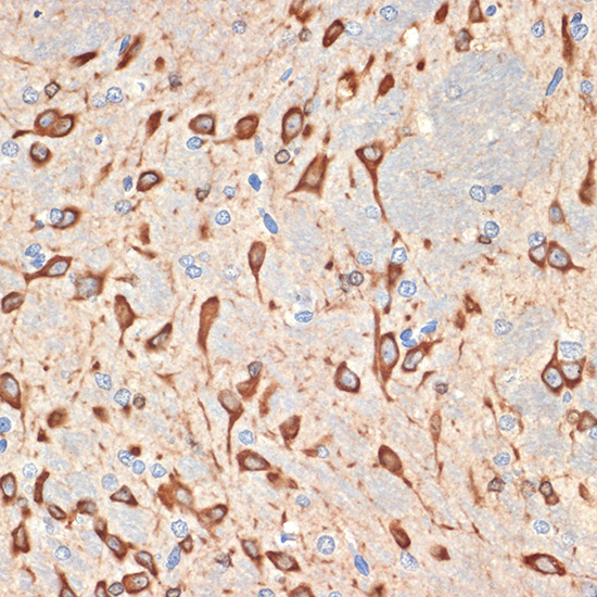 Musashi-2 (MSI2) Rabbit Monoclonal Antibody - Image 2