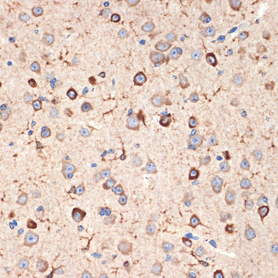 Musashi-2 (MSI2) Rabbit Monoclonal Antibody - Image 3