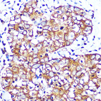 Muscarinic AChR M2 (ACM2) Rabbit Monoclonal Antibody - Image 2