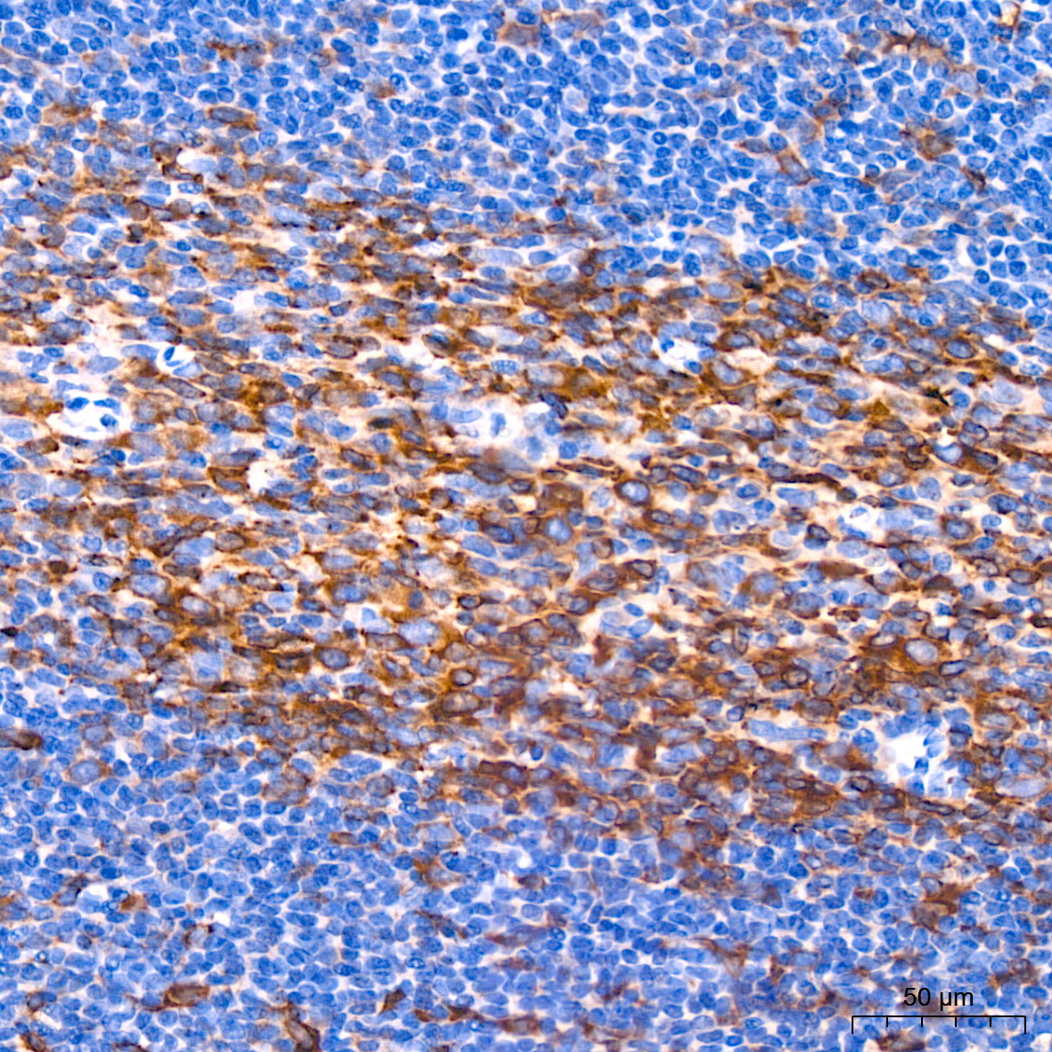 Muscarinic AChR M2 (ACM2) Rabbit Monoclonal Antibody - Image 3