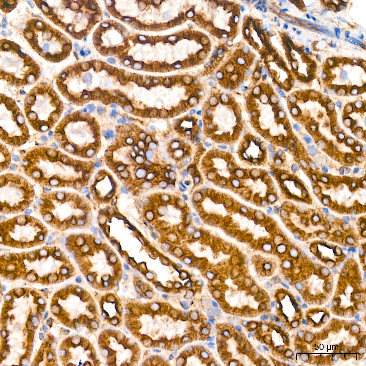 Muscarinic AChR M2 (ACM2) Rabbit Monoclonal Antibody - Image 4