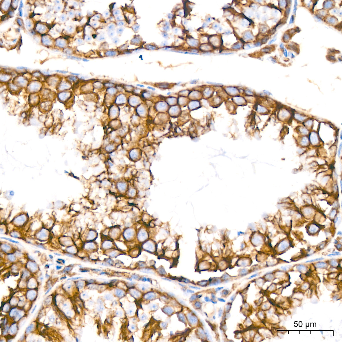 Muscarinic AChR M2 (ACM2) Rabbit Monoclonal Antibody - Image 5