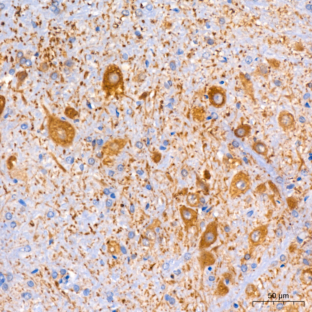 Muscarinic AChR M2 (ACM2) Rabbit Monoclonal Antibody - Image 6