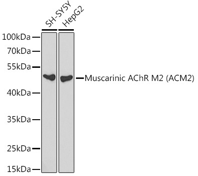 Muscarinic AChR M2 (ACM2) Rabbit Polyclonal Antibody