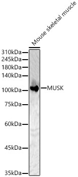 MUSK Rabbit Polyclonal Antibody