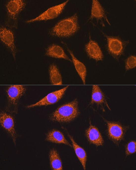 MUT Rabbit Polyclonal Antibody - Image 2