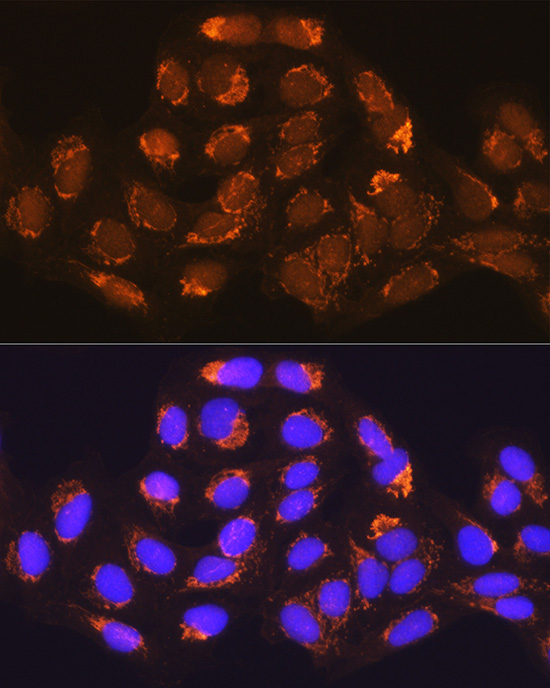 MUT Rabbit Polyclonal Antibody - Image 3