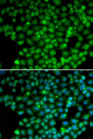 MUTYH Rabbit Polyclonal Antibody
