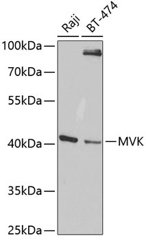 MVK Rabbit Polyclonal Antibody