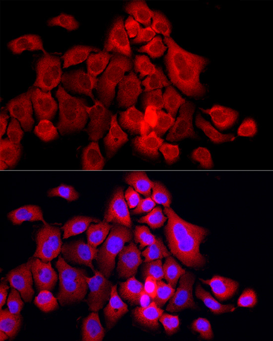 MX1 Rabbit Polyclonal Antibody - Image 3