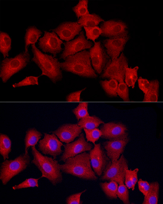 MX1 Rabbit Polyclonal Antibody - Image 4