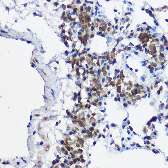 MYBBP1A Rabbit Polyclonal Antibody - Image 2