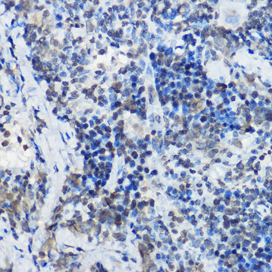 MYBBP1A Rabbit Polyclonal Antibody - Image 3