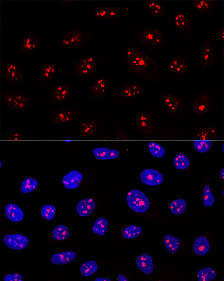 MYBBP1A Rabbit Polyclonal Antibody - Image 4