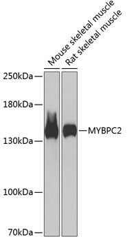 MYBPC2 Rabbit Polyclonal Antibody