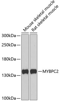 MYBPC2 Rabbit Polyclonal Antibody