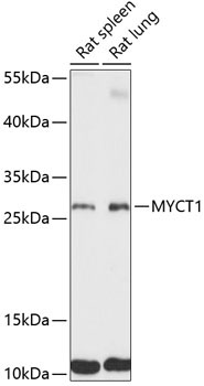 MYCT1 Rabbit Polyclonal Antibody