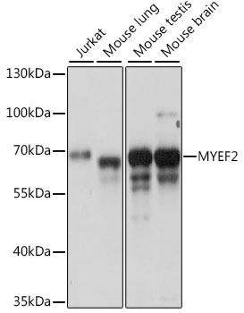 MYEF2 Rabbit Polyclonal Antibody