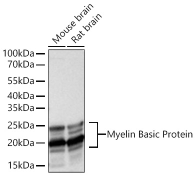 Myelin Basic Protein Rabbit Monoclonal Antibody
