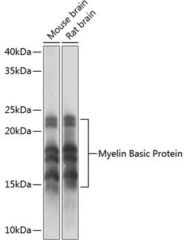 Myelin Basic Protein Rabbit Monoclonal Antibody