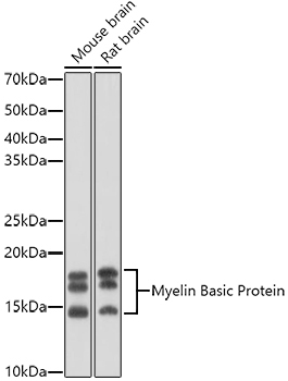Myelin Basic Protein Rabbit Polyclonal Antibody