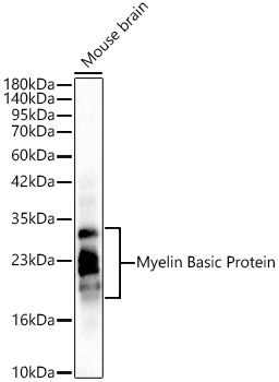 Myelin Basic Protein/MBP Rabbit Polyclonal Antibody