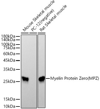 Myelin Protein Zero (MPZ) Rabbit Monoclonal Antibody