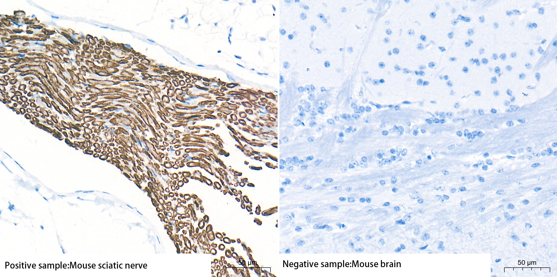 Myelin Protein Zero (MPZ) Rabbit Monoclonal Antibody - Image 2