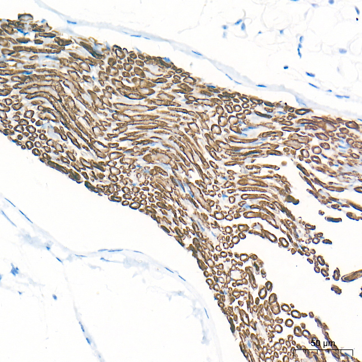Myelin Protein Zero (MPZ) Rabbit Monoclonal Antibody - Image 3