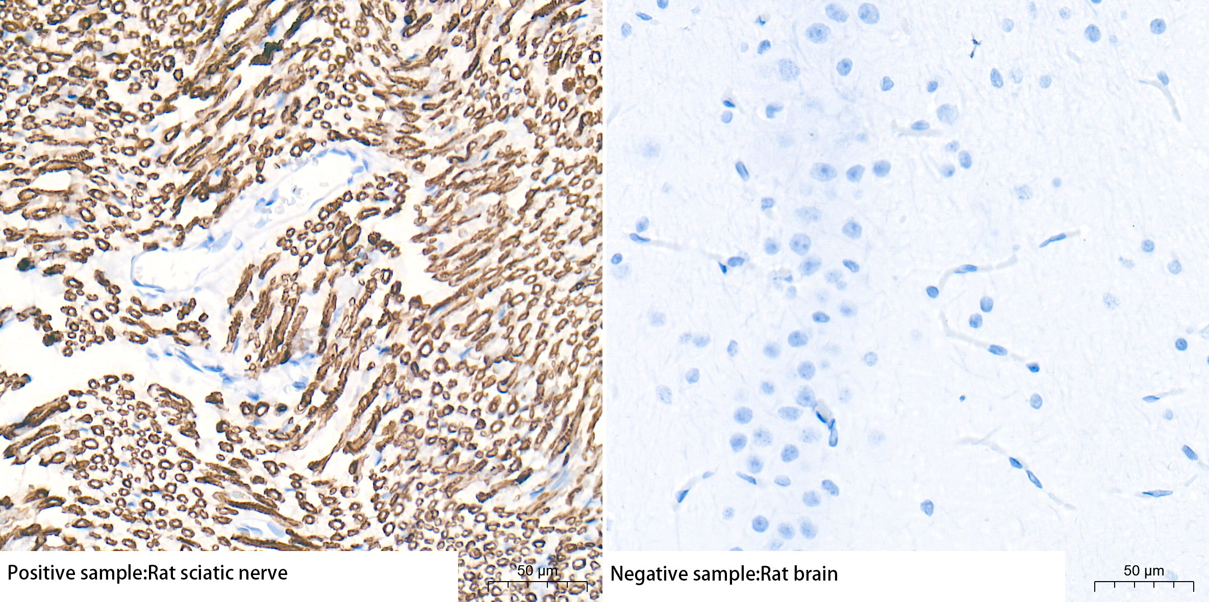 Myelin Protein Zero (MPZ) Rabbit Monoclonal Antibody - Image 4