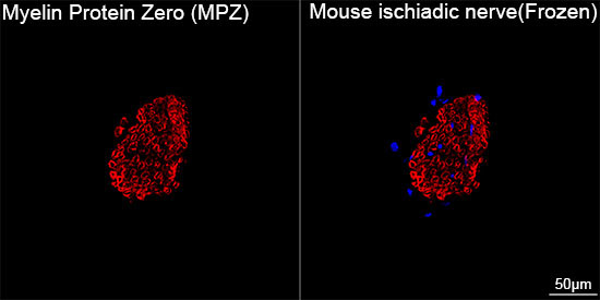 Myelin Protein Zero (MPZ) Rabbit Monoclonal Antibody - Image 6