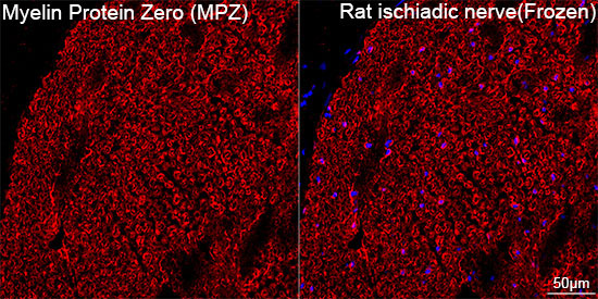 Myelin Protein Zero (MPZ) Rabbit Monoclonal Antibody - Image 7