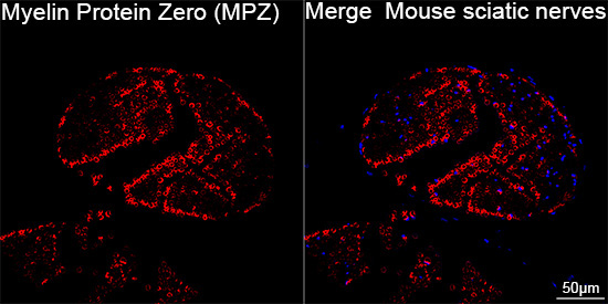 Myelin Protein Zero (MPZ) Rabbit Monoclonal Antibody - Image 8