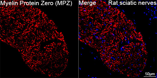 Myelin Protein Zero (MPZ) Rabbit Monoclonal Antibody - Image 9