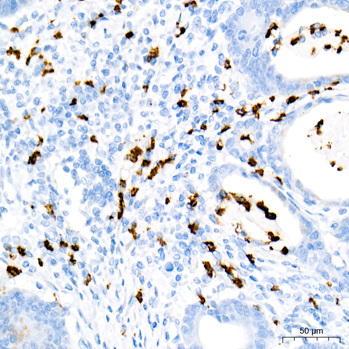 Myeloperoxidase (MPO) Rabbit Monoclonal Antibody